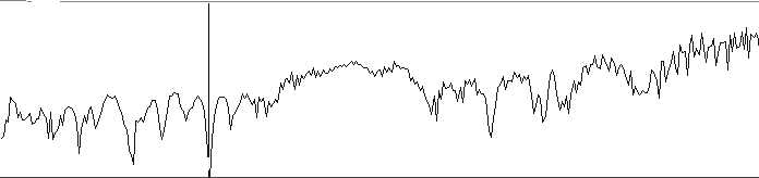 This is the C-3 octave and shows a worsening of the MT protein 
					as indicated by a downward truncation. This child has experienced 
					an increase in obsessive compulsive behavior and has not performed 
					well in school.