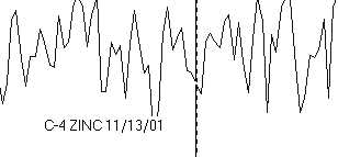 MT abnormal stringer no abnormal waveforms in any octave