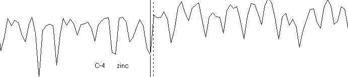 Zinc waveform after oral supplementation. Zinc remains low or deficient.